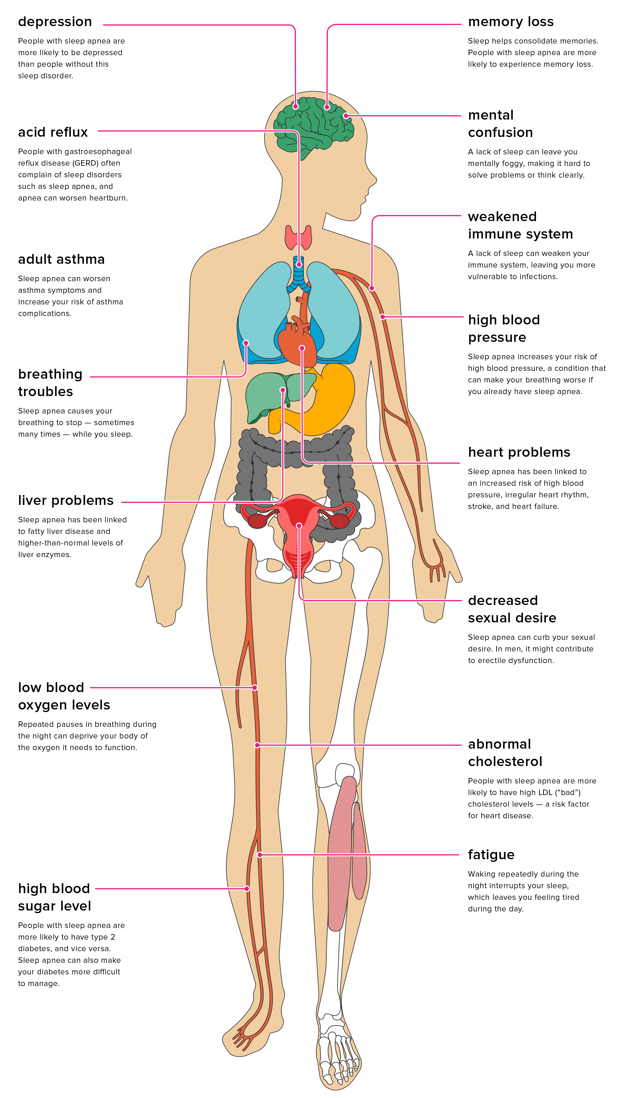 complication of obstructive sleep apnea
what will happen in sleep apnea
treat my snoring
snoring doctor in vaishali
snoring treatment in vaishali