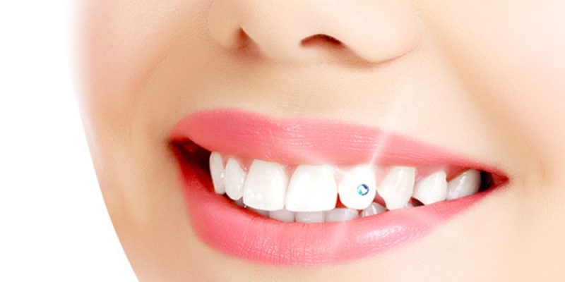 Tooth Jewellery dentist in vaishali
dental diamond in vaishali
diamonds in vaishali
teeth diamond in vaishali